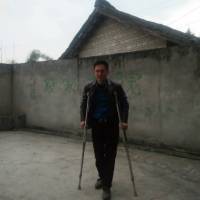 股骨头坏死患者