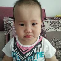 豆豆才一岁,请帮我留住她|患者:纪怡冰|疾病:右