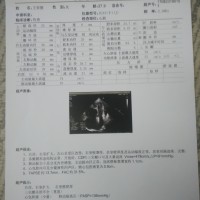 请大家拯救这个两个孩子的妈妈,延续曾经还幸