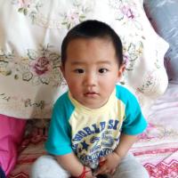 一岁多宝宝重度脑炎引起中枢神经重度受损急需