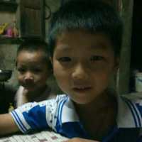 请帮帮我的外甥,五岁孩童烫伤身体多处。|患者