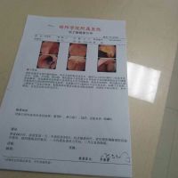 我的好妈妈,一辈子要被病魔折磨了。|患者:罗莲