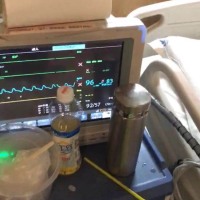 右肺腺癌中晚期|患者:张志强|疾病:右肺腺癌-水