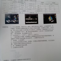 心捐款暖人心|患者:朱明贵|疾病:心脏瓣膜病-水