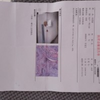 我对象24岁在医院检查出来是宫颈癌|患者:吴爱