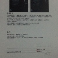 张晶检查出甲状腺癌淋巴转移请求大家帮帮我