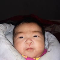 我的小女儿依靠呼吸机维持生命!先天性心脏病