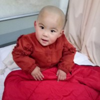 者:关思彤|疾病:先天性心脏病,房间隔缺损(继发