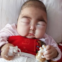 救救可怜的孩子|患者:高一航|疾病:肾病综合征伴