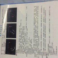 我的妈妈患有心脏联合瓣膜病,希望能够得到大