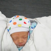 我女儿不拉胎便,经检查是先天性肠狭窄,粘连|患