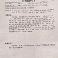 宫颈癌中晚期,转移到淋巴,需要手术、化疗、放