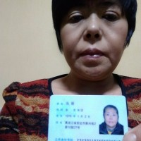 大家好,我是一名肾衰患者,想治病,换肾|患者:冯