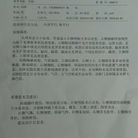 度过难关|患者:向超|疾病:右额颞顶硬膜下血肿-