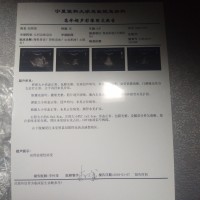 尿毒症,你走开,我才9岁|患者:赵煦琰|疾病:慢性肾