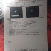 尿毒症,你走开,我才9岁|患者:赵煦琰|疾病:慢性肾