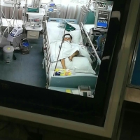 宝宝三年血癌抗争即将痊愈,突遭肺部感染生命