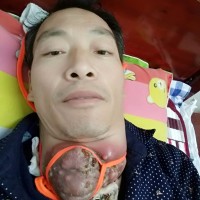 喉癌,舍不得抛下家人,希望大家伸出援手帮帮我