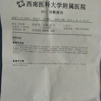 家人为了胸椎结核的我已经走投无路,求各位救