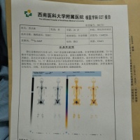 家人为了胸椎结核的我已经走投无路,求各位救