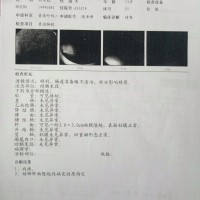 父亲为家操劳一生,却在晚年累倒了!