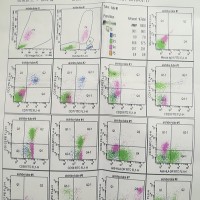 7岁回族小男孩勇战白血病