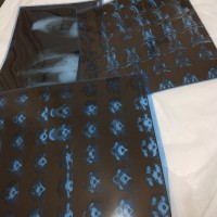 请大家救救咽喉癌的我,我想活下去!