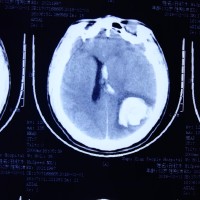 生命接力!希望大家可以帮助孙钦水活下去。