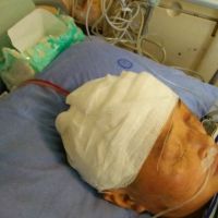 婆婆恶性肿瘤再次复发,生命危在旦夕,请大家救