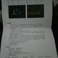 本人49岁急需做心脏换瓣膜手术,请大家帮帮我