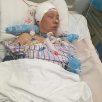 母亲突发脑出血病情严重,恳求好心人伸出援手