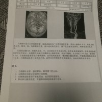母亲突发脑出血病情严重,恳求好心人伸出援手