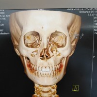 因意外受伤急需手术费