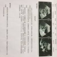 宫颈癌求求你放过我吧,我还舍不得离开这世界