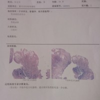 请大家救救胃癌的我,我想活下去!