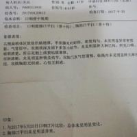 请大家救救口咽癌的我,我想活下去!