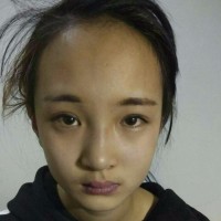 妈妈!我想摆脱先天性心脏病房缺,去看看世界!