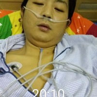 李建军_肝炎后肝硬化,肝功能失代偿合并腹腔积