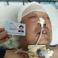 我爸是一名昔阳环卫工人因出车祸头部受伤