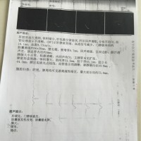 保户困难户患肝硬化失代偿期.需要肝移植.特申