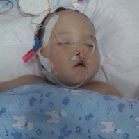 拜托了!不要让蛛网膜囊肿从我手中夺走她!