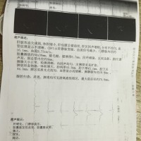 保户困难户患肝硬化失代偿期.需要肝移植.特申