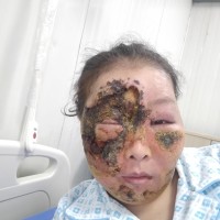 患病6年日夜被病魔折磨,我想活着!大家帮帮我