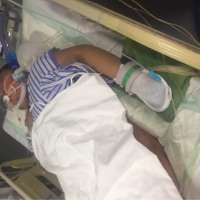 我儿子因为流感重度肺炎,每天靠呼吸机维持