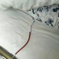 妹妹突发大病至今未好,请求大家帮帮忙。