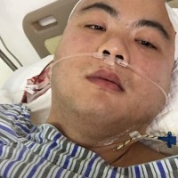 帮帮我!让身患小细胞恶性肿瘤的我在人世上活