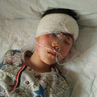 救救头部严重摔伤的我,这世界我刚来,我还不想