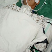 我的父亲|患者:陈品泉|疾病:脑疝,高血压病3级、