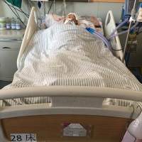 母亲脑出血复发了我该怎么办!请帮帮我!