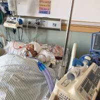 母亲脑出血复发了我该怎么办!请帮帮我!